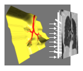 LungPrint Positioning and Product Training_08-2020 2020-08-21 14-20-27