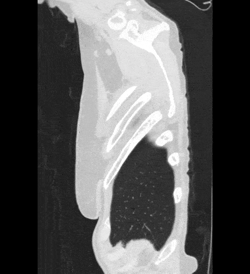 sagittal-untinted